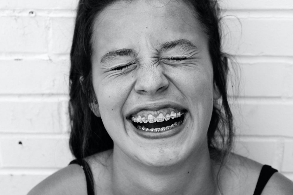 Tannregulering: Reisen mot et strålende smil vi alle kan relatere til